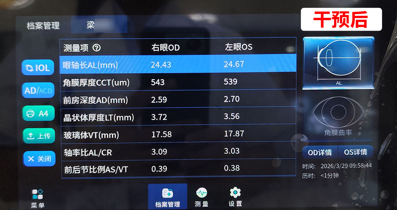 干预后