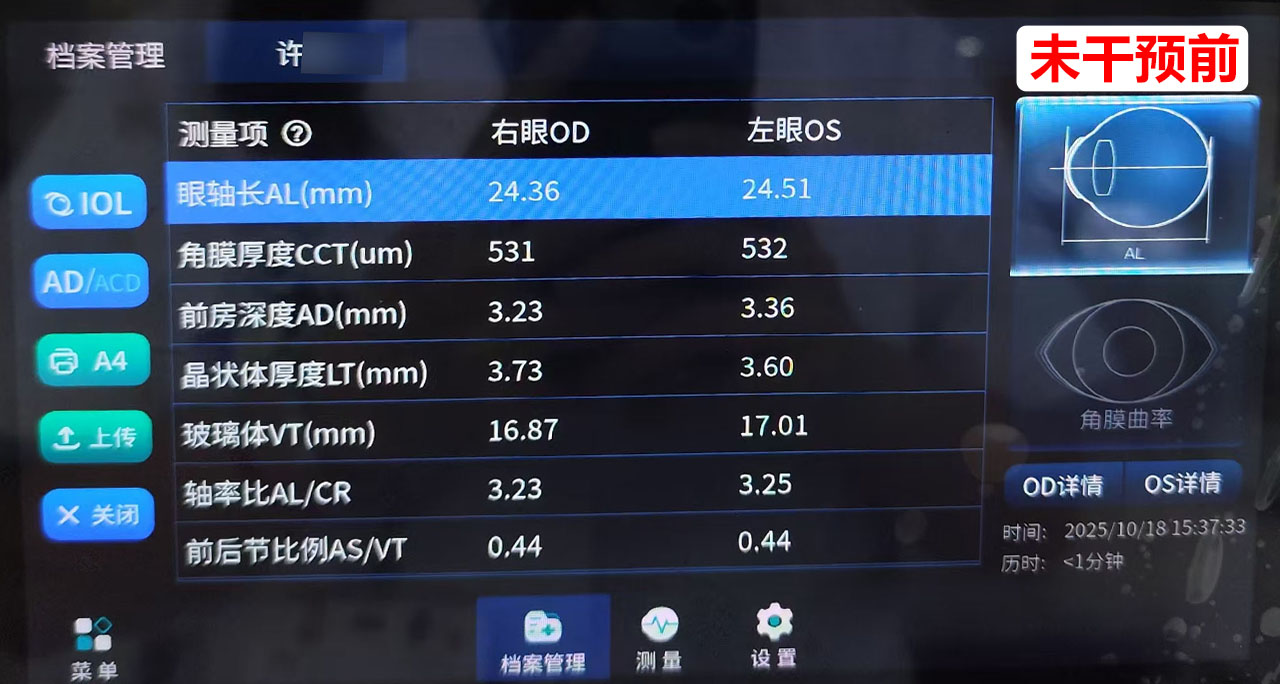 干预前