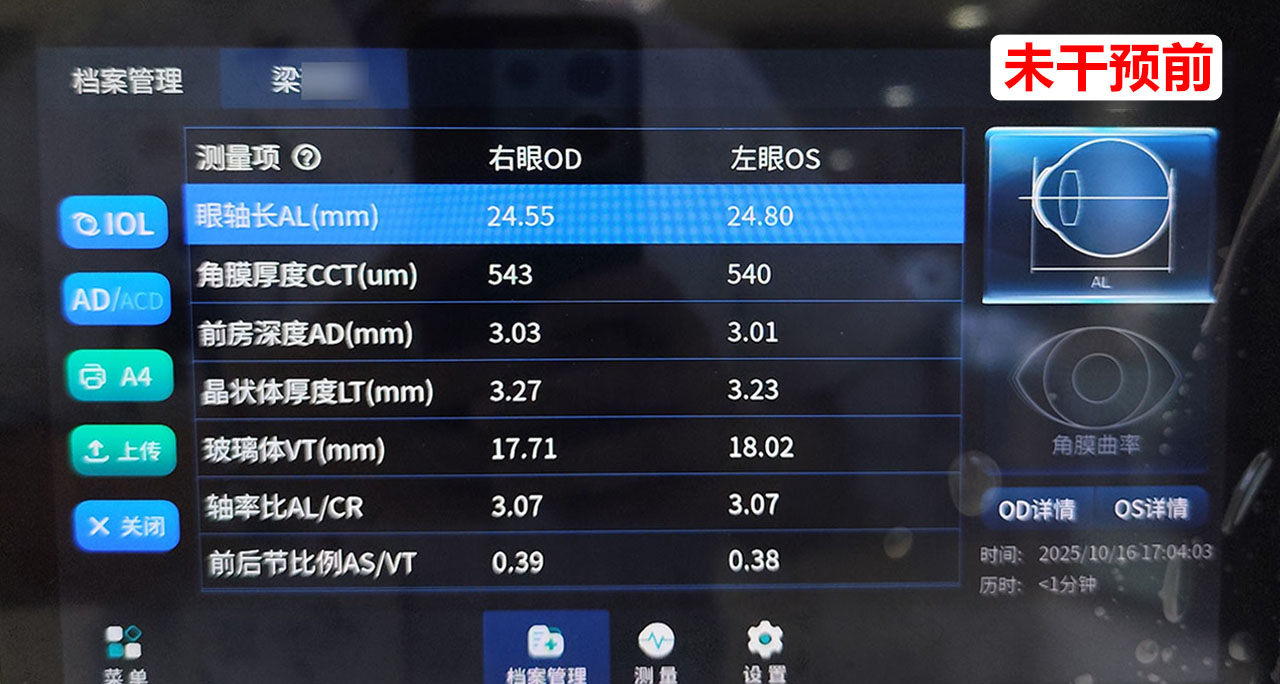 干预前